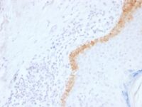 Formalin-fixed, paraffin-embedded human Skin Stained with Cytokeratin 15 Monoclonal Antibody (LHK15).