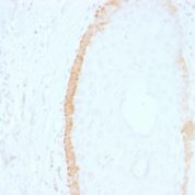 Formalin-fixed, paraffin-embedded human Skin Stained with Cytokeratin 15 Mouse Monoclonal Antibody (SPM19).