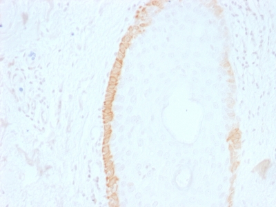 Formalin-fixed, paraffin-embedded human Skin Stained with Cytokeratin 15 Mouse Monoclonal Antibody (SPM19).
