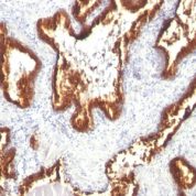 Formalin-fixed, paraffin-embedded Rat Colon stained with Cytokeratin 18 Monoclonal Antibody (KRT18/119).