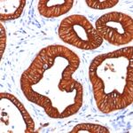 Western Blot 1) HeLa and 2) A431 Lysate using Cytokeratin 18 Monoclonal Antibody (SPM265).