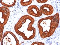 Western Blot 1) HeLa and 2) A431 Lysate using Cytokeratin 18 Monoclonal Antibody (SPM265).