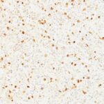 Formalin-fixed, paraffin-embedded human Pituitary stained with LH-beta Monoclonal Antibody (LHb/1214).