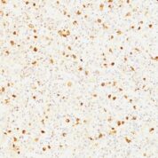 Formalin-fixed, paraffin-embedded human Pituitary stained with LH-beta Monoclonal Antibody (LHb/1214).