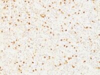 Formalin-fixed, paraffin-embedded human Pituitary stained with LH-beta Monoclonal Antibody (LHb/1214).