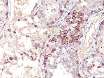 Formalin-fixed, paraffin-embedded human Testis stained with MAGE-1 Monoclonal Antibody (MA454).