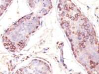 Formalin-fixed, paraffin-embedded human Testis stained with MAGE-1 Monoclonal Antibody (SPM282).