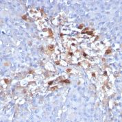Formalin-fixed, paraffin-embedded human Tonsil stained with CD146 Monoclonal Antibody (C146/634)
