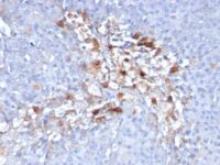 Formalin-fixed, paraffin-embedded human Tonsil stained with CD146 Monoclonal Antibody (C146/634)