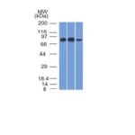 Formalin-fixed, paraffin-embedded human Tonsil stained with MCM7 Monoclonal Antibody (MCM7/1466).