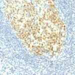 Formalin-fixed, paraffin-embedded human Tonsil stained with MCM7 Monoclonal Antibody (MCM7/1467).