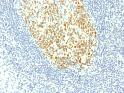 Formalin-fixed, paraffin-embedded human Tonsil stained with MCM7 Monoclonal Antibody (MCM7/1467).