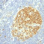 Formalin-fixed, paraffin-embedded human Tonsil stained with MCM7 Monoclonal Antibody (MCM7/1469).