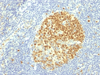 Formalin-fixed, paraffin-embedded human Tonsil stained with MCM7 Monoclonal Antibody (MCM7/1469).