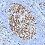 Formalin-fixed, paraffin-embedded human Tonsil stained with MCM7 Monoclonal Antibody (SPM379).