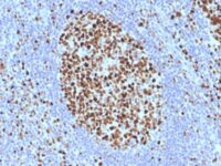 Formalin-fixed, paraffin-embedded human Tonsil stained with MCM7 Monoclonal Antibody (SPM379).