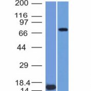 Western Blot  of (1) Recombinant MMP2 protein and (2) U87 Cell Lysate using MMP2 Monoclonal Antibody (MMP2/151).