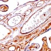 Formalin-fixed, paraffin-embedded human Placenta stained with Moesin Monoclonal Antibody (SPM562)
