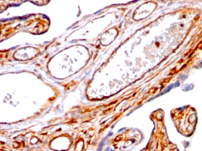 Formalin-fixed, paraffin-embedded human Placenta stained with Moesin Monoclonal Antibody (SPM562)