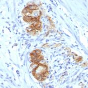 Formalin-fixed, paraffin-embedded human Colon Ganglion stained with CD56 Monoclonal Antibody (123C3.D5)