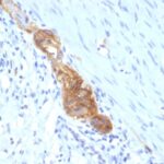 Formalin-fixed, paraffin-embedded human Colon stained with CD56 Monoclonal Antibody (SPM489)