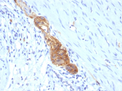 Formalin-fixed, paraffin-embedded human Colon stained with CD56 Monoclonal Antibody (SPM489)