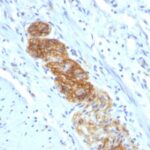 Formalin-fixed, paraffin-embedded human Colon stained with CD56 Monoclonal Antibody (NCAM1/784)