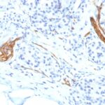 Formalin-fixed, paraffin-embedded human Pancreas stained with CD56 Monoclonal Antibody (NCAM1/1496)