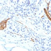 Formalin-fixed, paraffin-embedded human Pancreas stained with CD56 Monoclonal Antibody (NCAM1/1496)