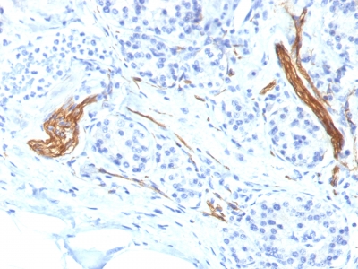 Formalin-fixed, paraffin-embedded human Pancreas stained with CD56 Monoclonal Antibody (NCAM1/1496)