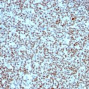 Formalin-fixed, paraffin-embedded human Tonsil stained with Nucleolin Monoclonal Antibody (SPM614).