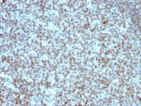 Formalin-fixed, paraffin-embedded human Tonsil stained with Nucleolin Monoclonal Antibody (SPM614).