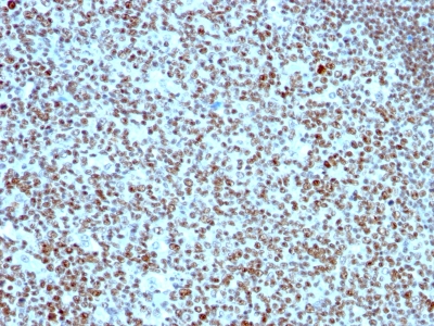 Formalin-fixed, paraffin-embedded human Tonsil stained with Nucleolin Monoclonal Antibody (SPM614).