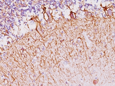 Formalin-fixed, paraffin-embedded Rat Cerebellum stained with Neurofilament Monoclonal Antibody (NF421).