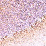Formalin-fixed, paraffin-embedded human Cerebellum stained with Neurofilament Monoclonal Antibody (SPM563).