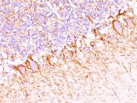 Formalin-fixed, paraffin-embedded human Cerebellum stained with Neurofilament Monoclonal Antibody (SPM23).