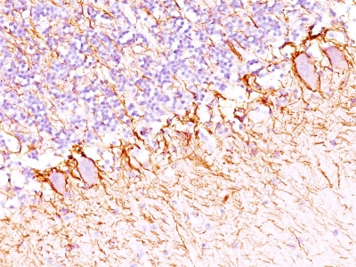 Formalin-fixed, paraffin-embedded human Cerebellum stained with Neurofilament Monoclonal Antibody (SPM23).