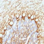 Formalin-fixed, paraffin-embedded Rat Cerebellum stained with Neurofilament Monoclonal Antibody (NE14).