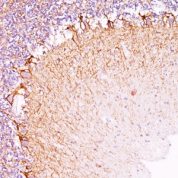 Formalin-fixed, paraffin-embedded Rat Cerebellum stained with Neurofilament Monoclonal Antibody (NR-4).