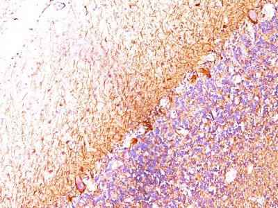 Formalin-fixed, paraffin-embedded Cerebellum stained with Neurofilament Monoclonal Antibody (SPM24).