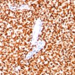 Formalin-fixed paraffin-embedded human Pancreas stained with NKX2.2 Monoclonal Antibody (SPM564).