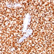 Formalin-fixed paraffin-embedded human Pancreas stained with NKX2.2 Monoclonal Antibody (SPM564).