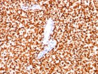 Formalin-fixed paraffin-embedded human Pancreas stained with NKX2.2 Monoclonal Antibody (SPM564).