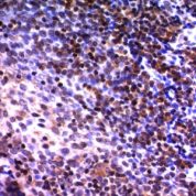 Formalin-fixed, paraffin-embedded human Tonsil stained with NuMA Monoclonal Antibody (A73-B/D12)