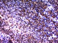 Formalin-fixed, paraffin-embedded human Tonsil stained with NuMA Monoclonal Antibody (A73-B/D12)