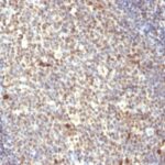 Formalin-fixed, paraffin-embedded human Tonsil stained with NuMA Monoclonal Antibody (SPM3)