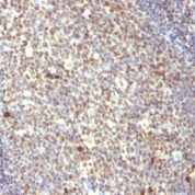 Formalin-fixed, paraffin-embedded human Tonsil stained with NuMA Monoclonal Antibody (SPM3)