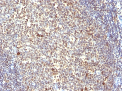 Formalin-fixed, paraffin-embedded human Tonsil stained with NuMA Monoclonal Antibody (SPM3)