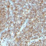 Formalin-fixed, paraffin-embedded human Tonsil stained with PCNA Monoclonal Antibody (SPM35)