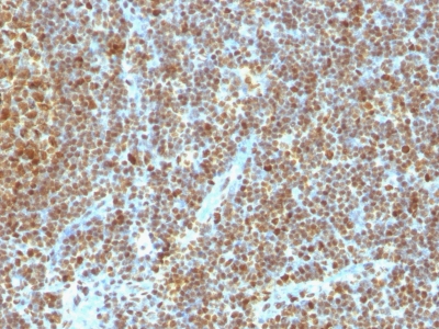 Formalin-fixed, paraffin-embedded human Tonsil stained with PCNA Monoclonal Antibody (SPM35)